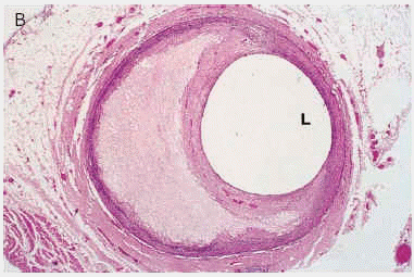 Luz Vascular