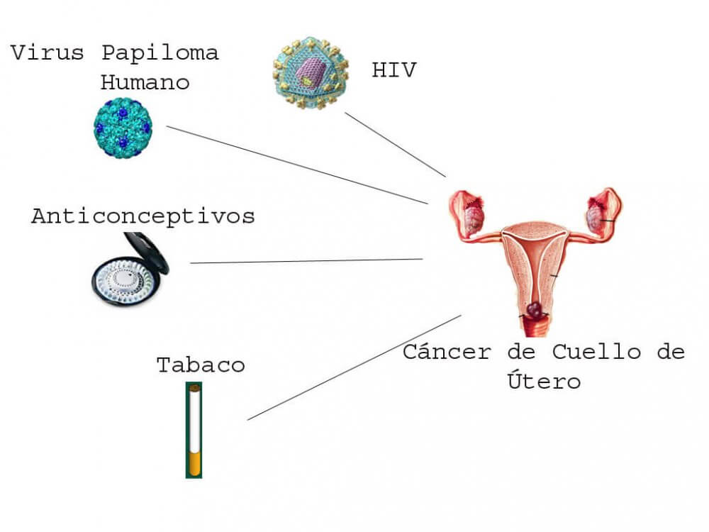 cáncer útero