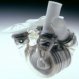 corazon2 10 Novedosas Tecnologías para el Desarrollo de Órganos Artificiales