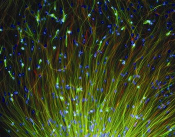 Células madre neurales humanas